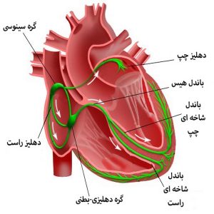دستگاه هادی قلب